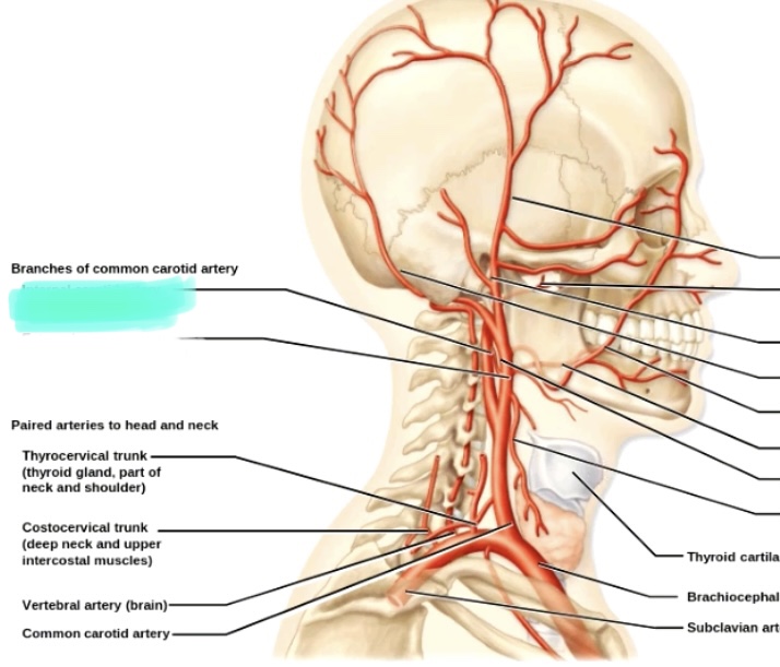 <p>Right internal carotid artery</p>