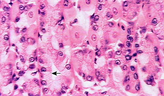 <p>Chief cells→ pepsin→ break down proteins (purple nucleus)</p><p>Parietal cells→ Hydrochloric acid (HCL)→ digests, lowers pH to kill bacteria &amp; Intrinsic Factor→ Vit B12 absorption (pink nucleus)</p><p>Enteroendocrine→ gastrin→ stimulates secretions</p><p>(found in stomach mucosa)</p>
