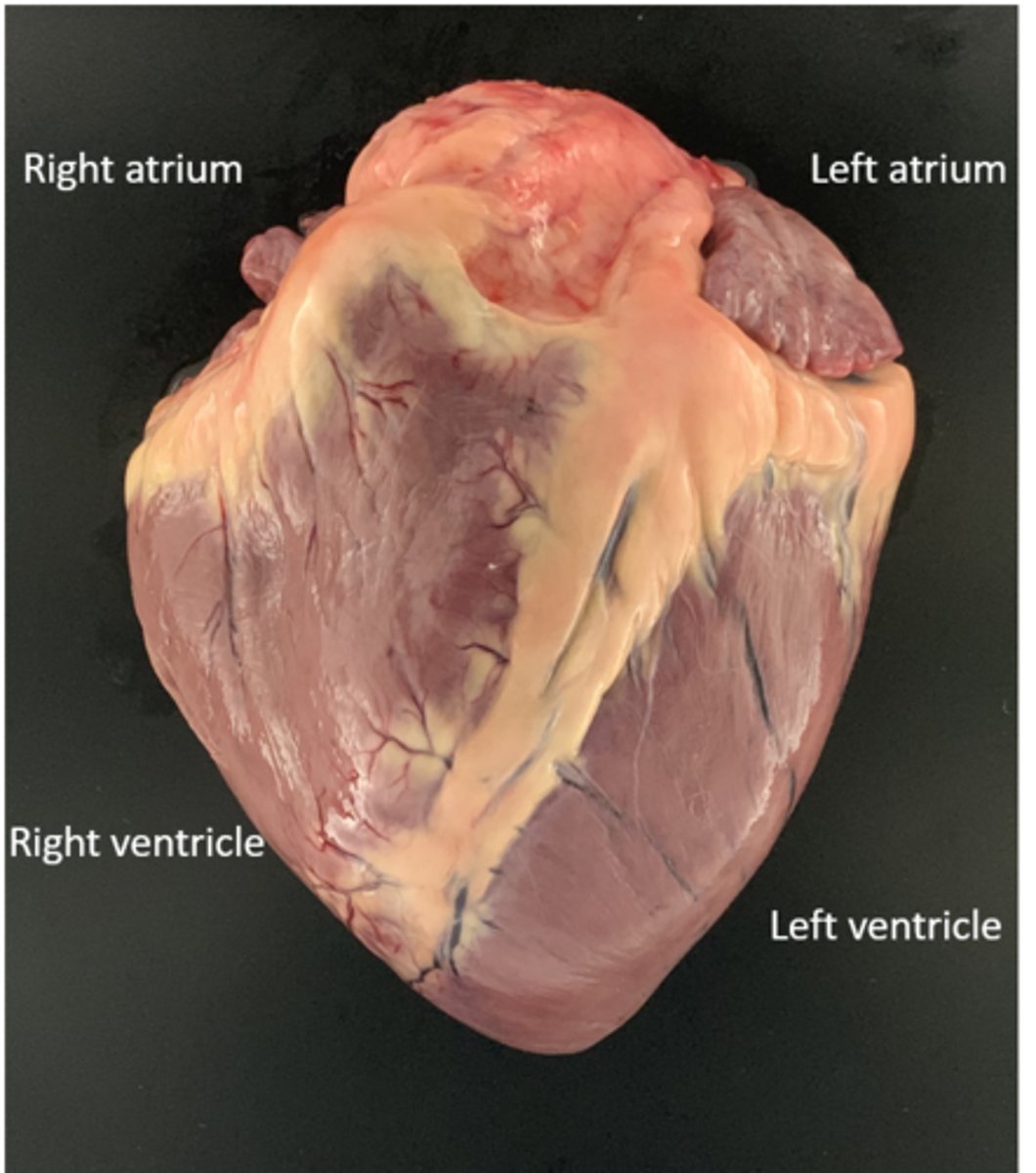 <p>What layer of the heart is visible?</p>