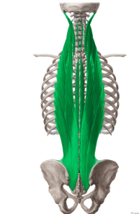 <p>Erector spinae Origin</p>