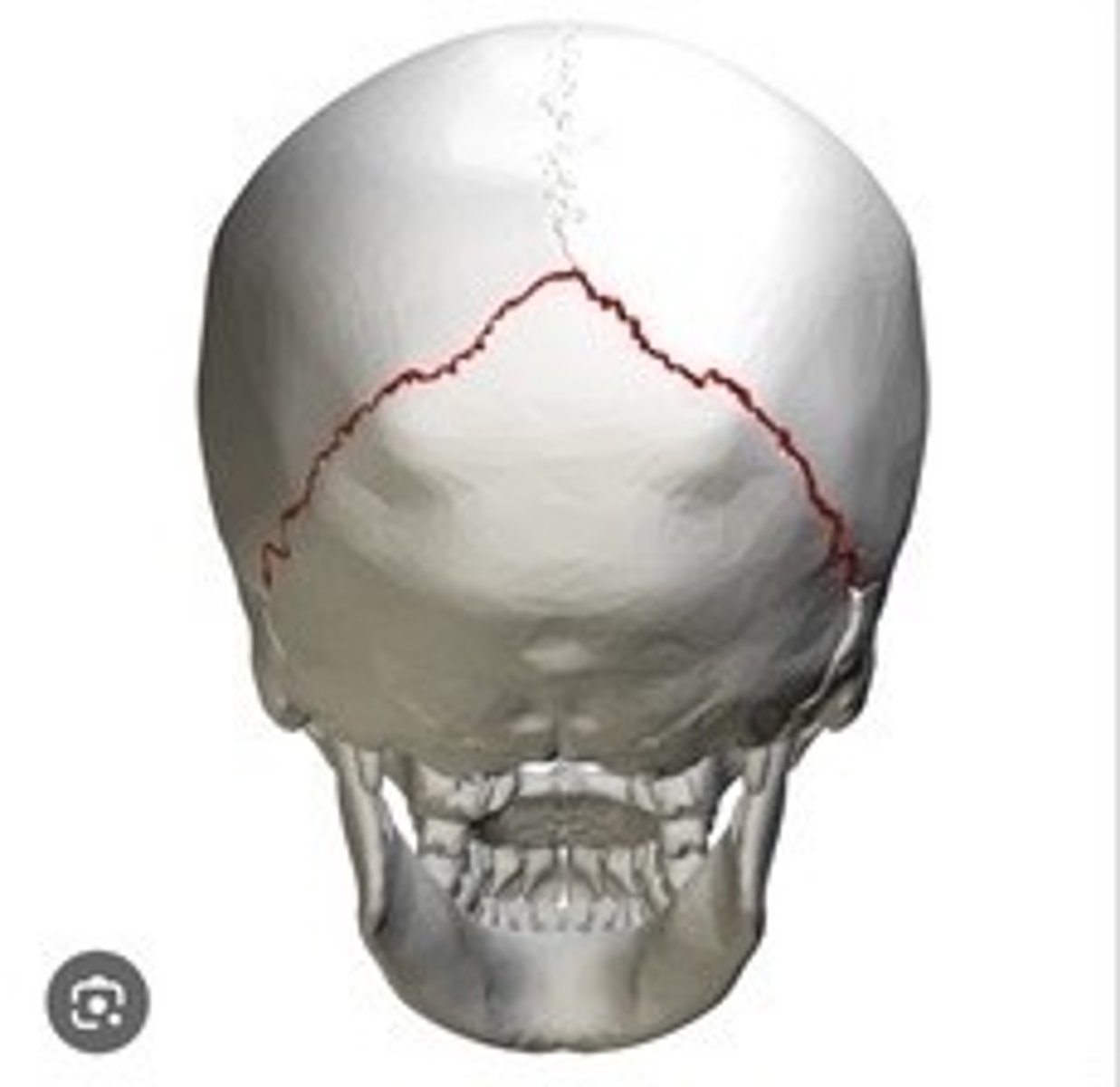 <p>Fibrous joints connecting skull bones.</p>
