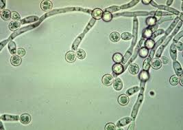 <p>What species of yeast has these results:</p><p>germ tube: -</p><p>blastoconidia</p><p>pseduohyphae</p><p><strong>chlamydospores</strong></p>