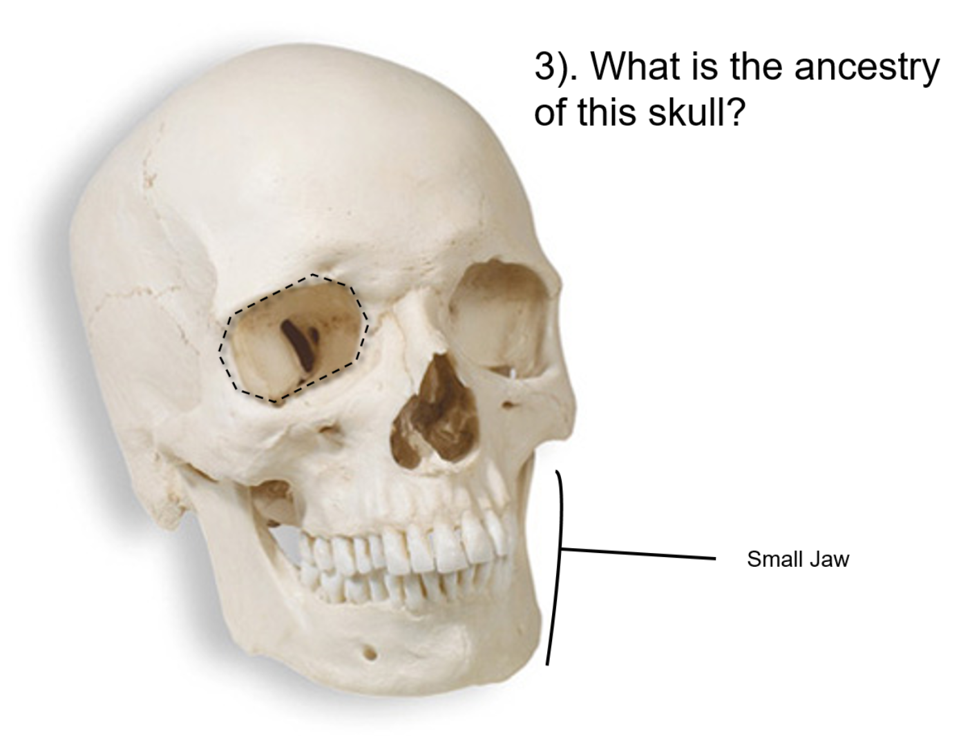<p><span>What is the ancestry of this skull?</span></p>