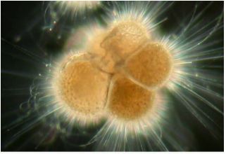 <p>neogloboquadrina pachyderma</p>