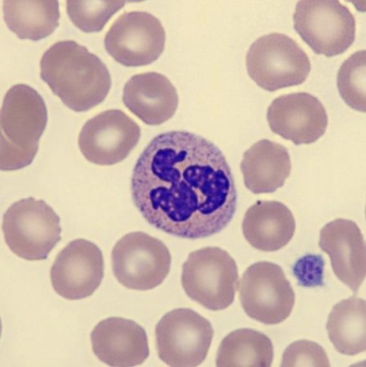 <p>What is this leukocyte?</p>