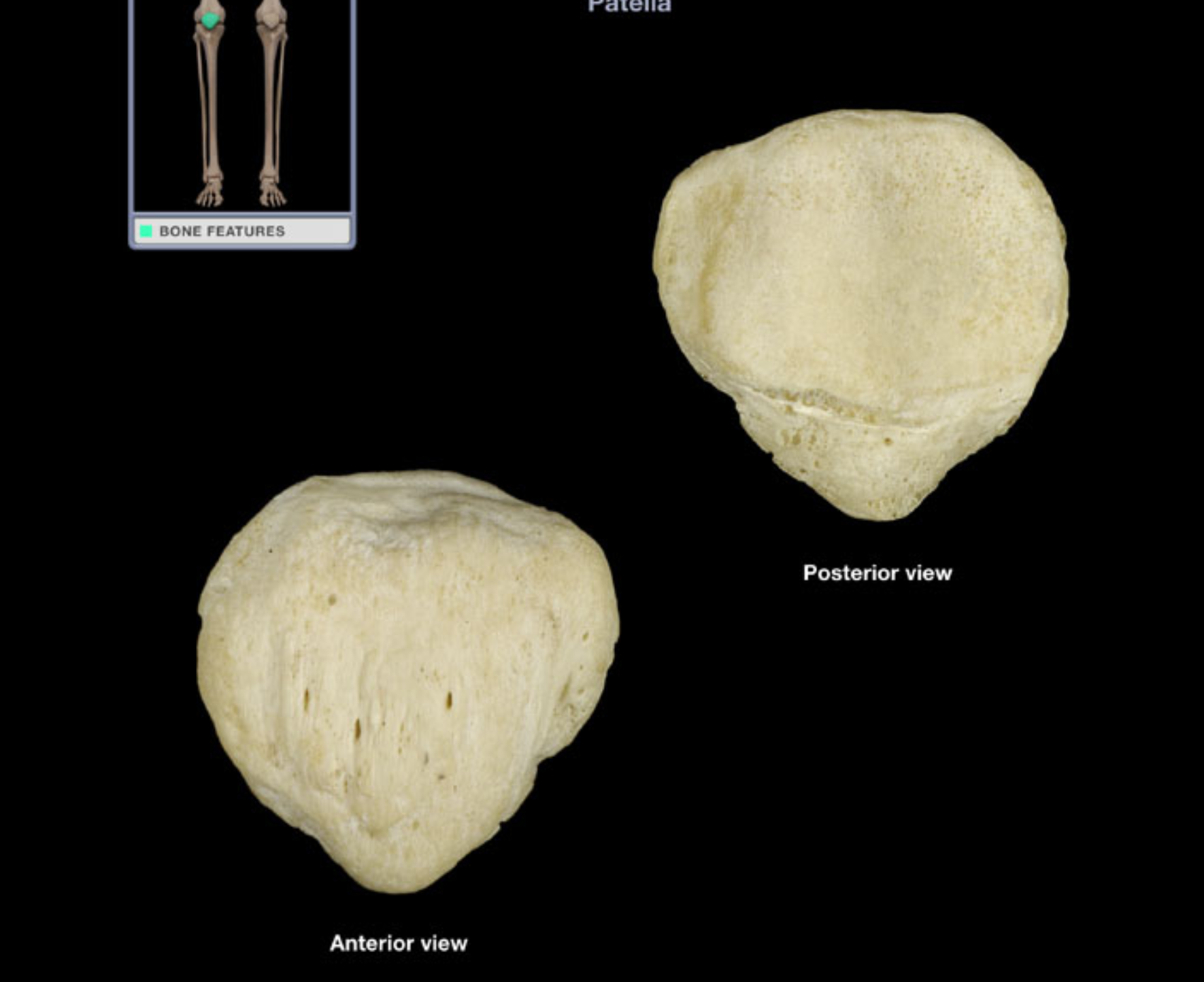 <p>Patella!!!!</p>