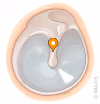 <p>what part of the ear is this</p>