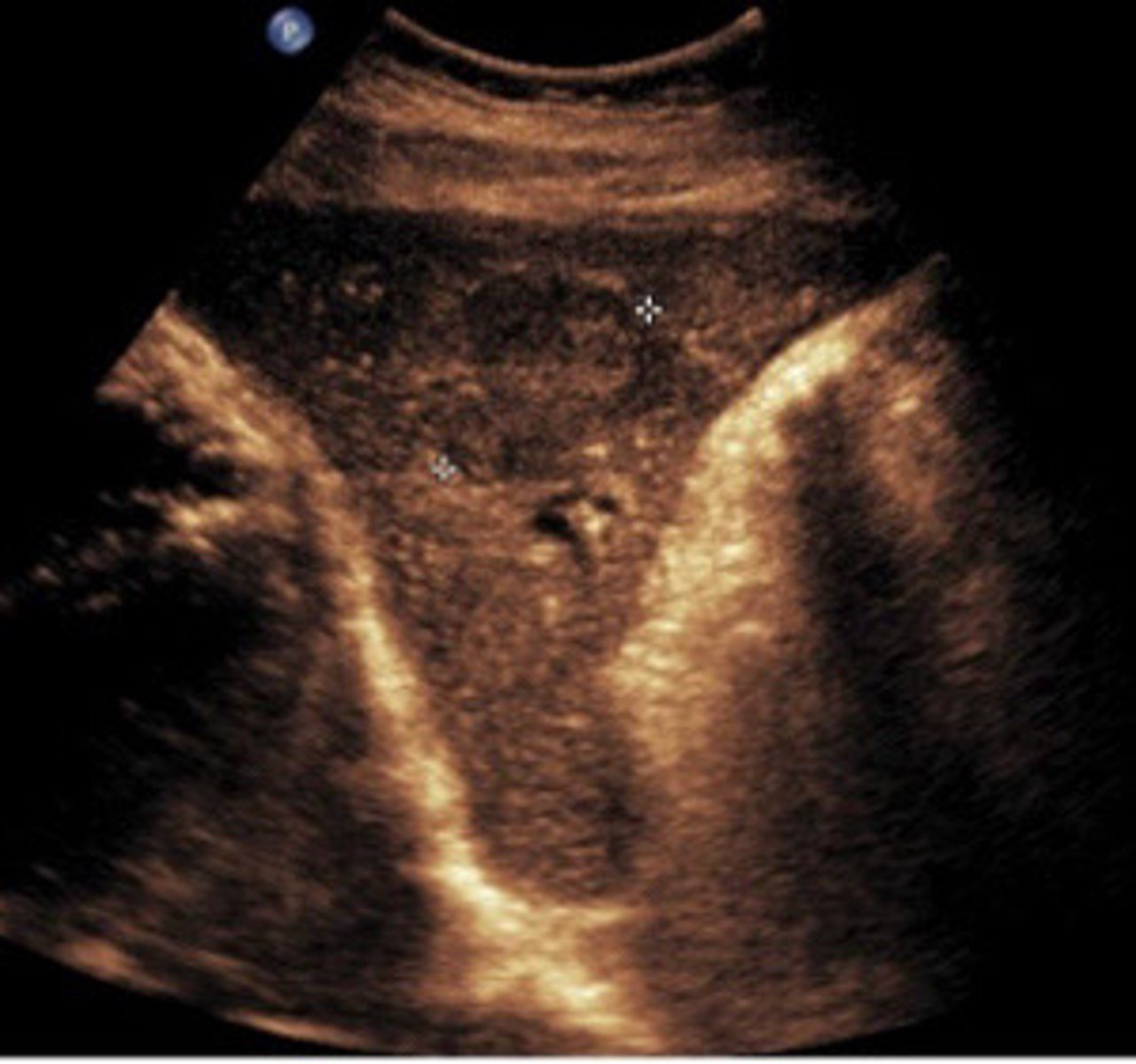 <p>What does this image show</p>