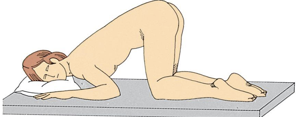 <p>RECTAL AREA (FOR BRIEF PERIODS)</p>