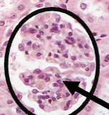 <p>What is on the arrow</p>