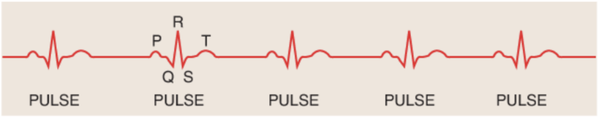 <p>Because they reflect cardiac activity&nbsp;</p>