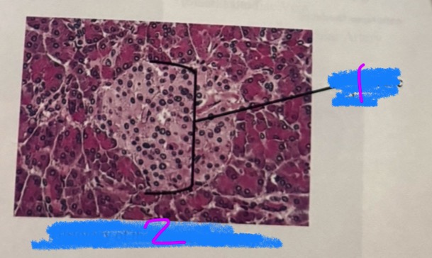 <p>What is this an image of? (2)</p>