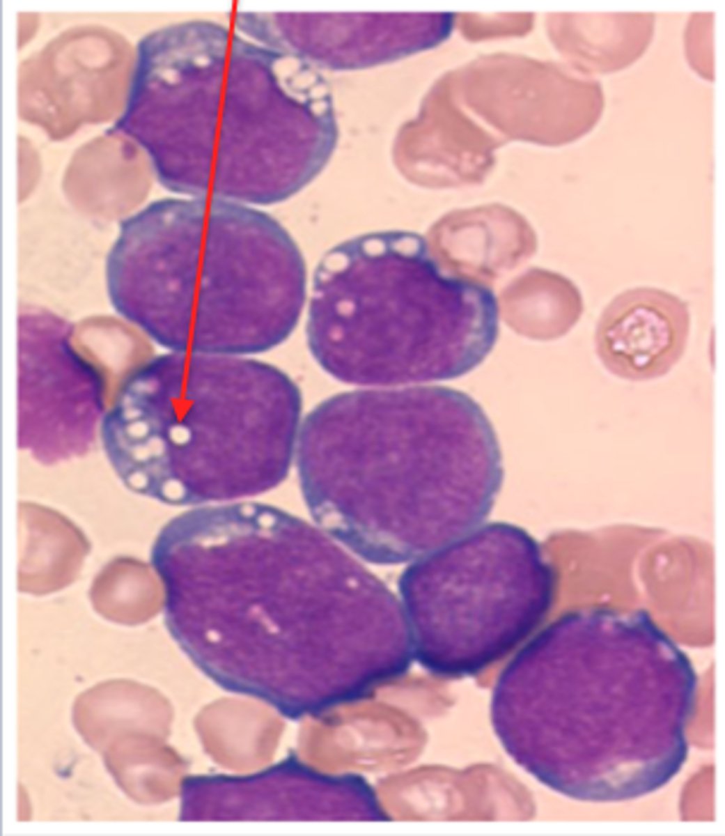 <p>What is this reactive change in neutrophils?</p>