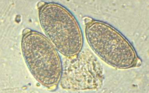<p>is <span>Eucoleus aerophilus zoonotic </span></p>
