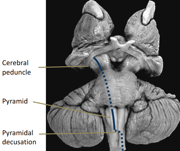 <p>Motor fibers pass within the internal capsule and then form the cerebral peduncles and the pyramids. Some fibers (corticobulbar) end in the brainstem. Others (corticospinal) project to the spinal cord (contralateral as it moves down.)</p><ul><li><p>Travel through pons</p></li></ul><p></p>