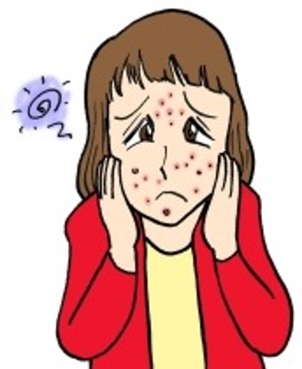 <p>びんかん(な) mẫn cảm</p>