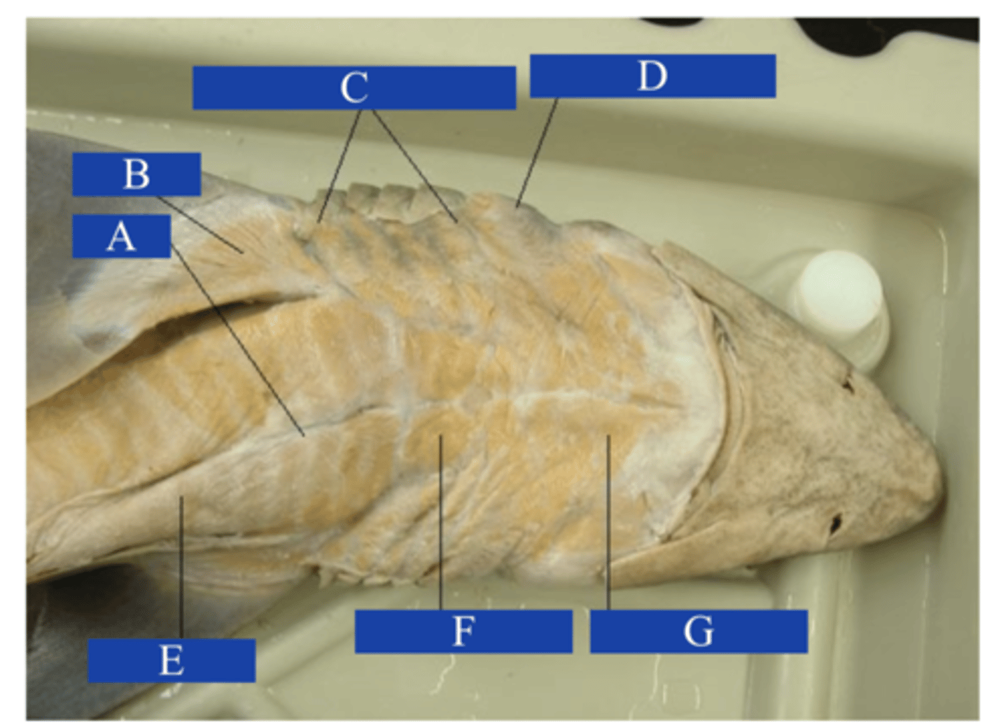 <p>What does letter G point to?</p>
