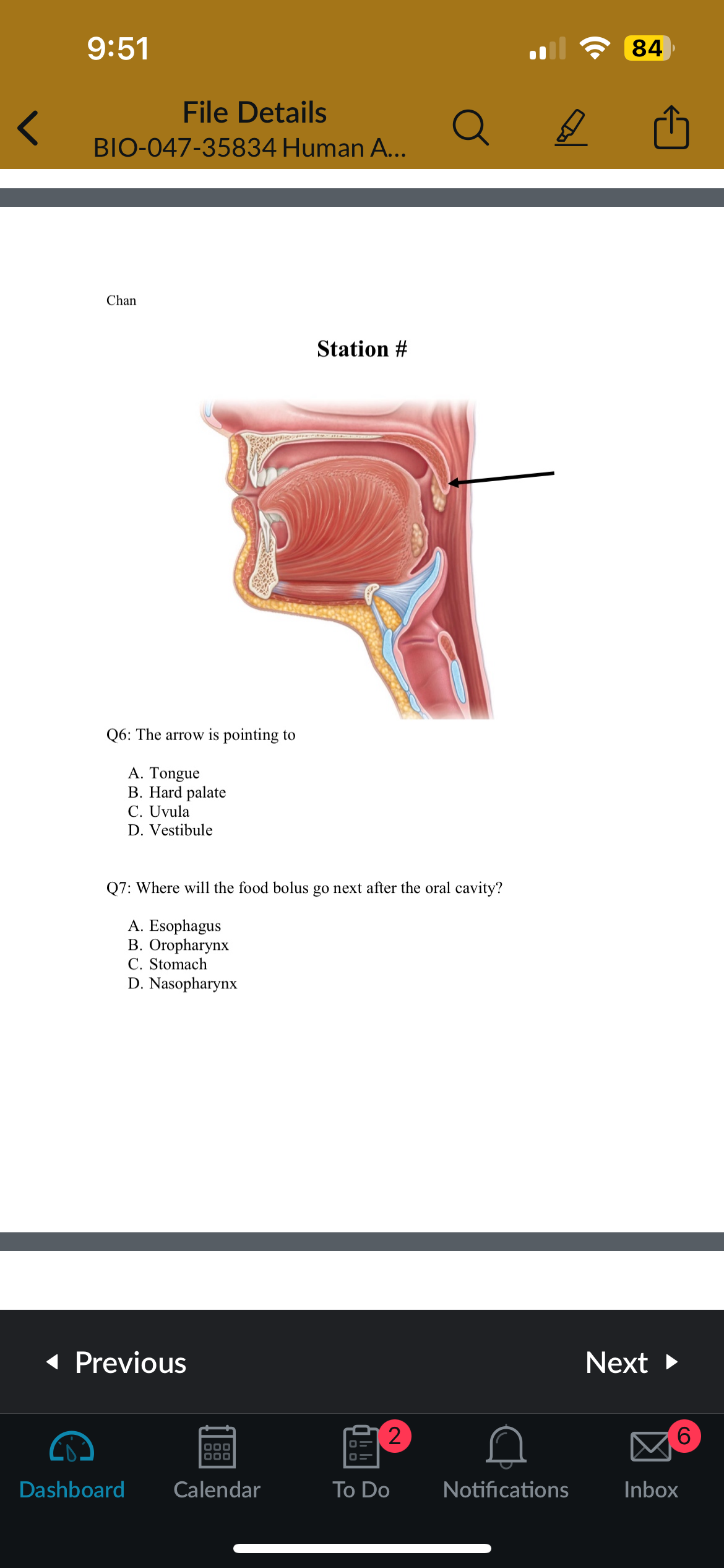 <p>Q6: The arrow is pointing to</p>
