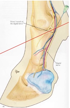 <p>what is desensitized in an abaxial sesamoid nerve block “basisesamoid block”</p>