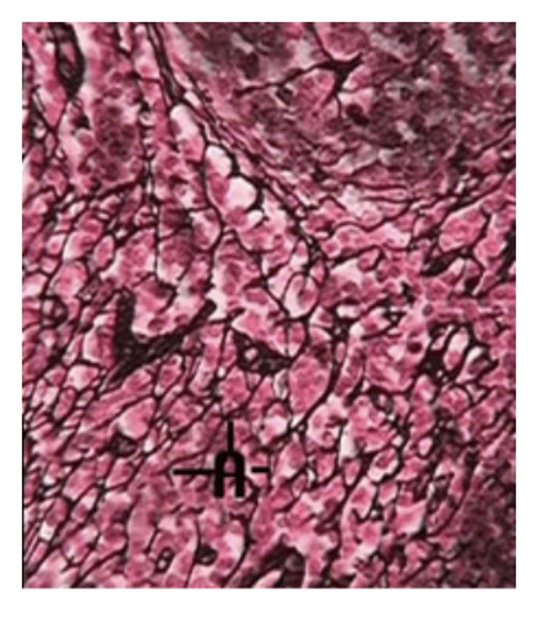 <p>- A network of thin fibers (reticular fibers)</p><p>- Forms a mesh-like internal support system</p><p>- Function: supports and holds organs together, creates a framework inside organs.</p><p>- Location: Liver, spleen, and lymph nodes.</p>
