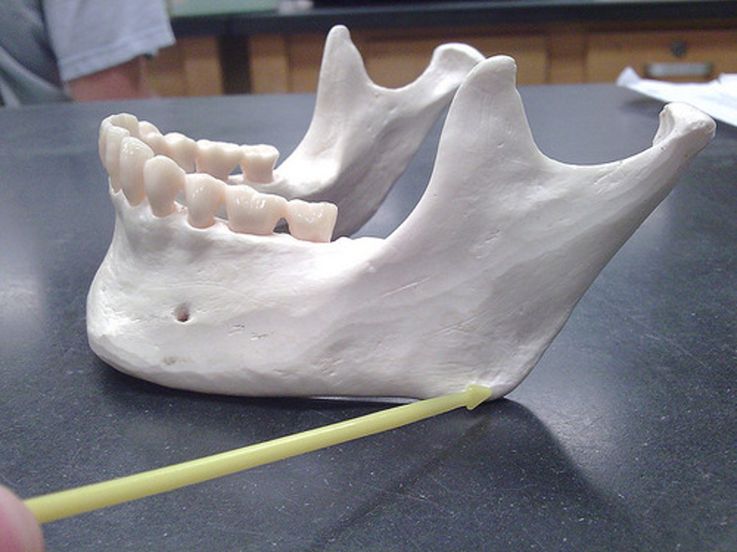 <p>angle at the posterior border where the ramus and the body meet</p>