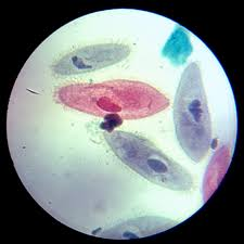 <p>what is this protist?</p>