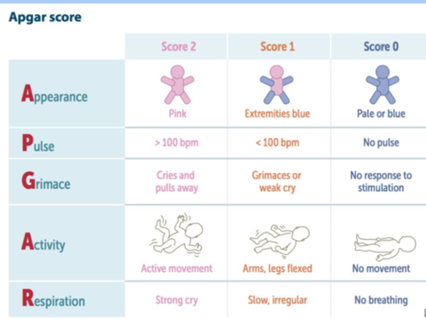 <p>-standardized assessment of a newborns health immediately after birth</p><p>-at 1 and 5 min of age</p><p>-normal 7-10</p><p>-requires immediate resuscitation 0-3</p>