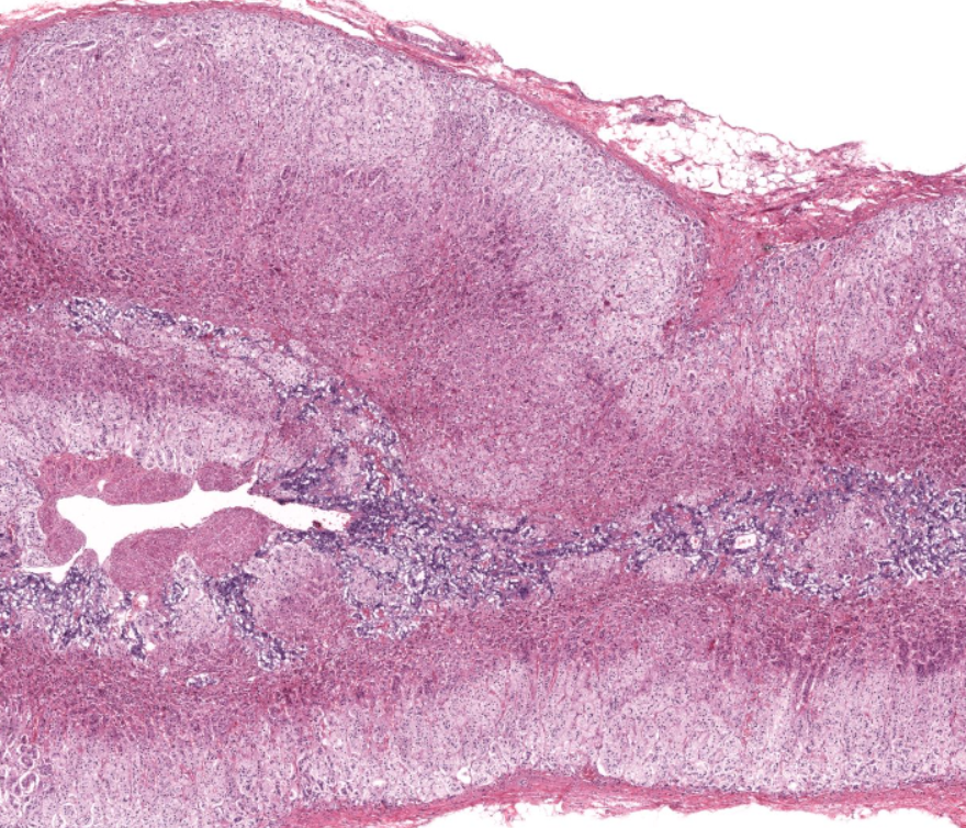 term image