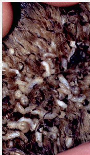 <p>What is this condition? Treatment and prevention?</p>