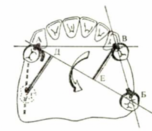 <p>theoretical line around which a removable dental prosthesis tends to rotate </p>