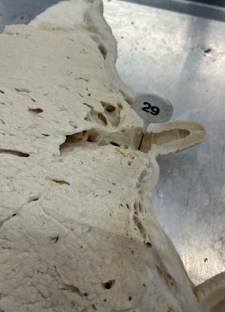 <p>What specific spaces exist on either side of this structure?</p>