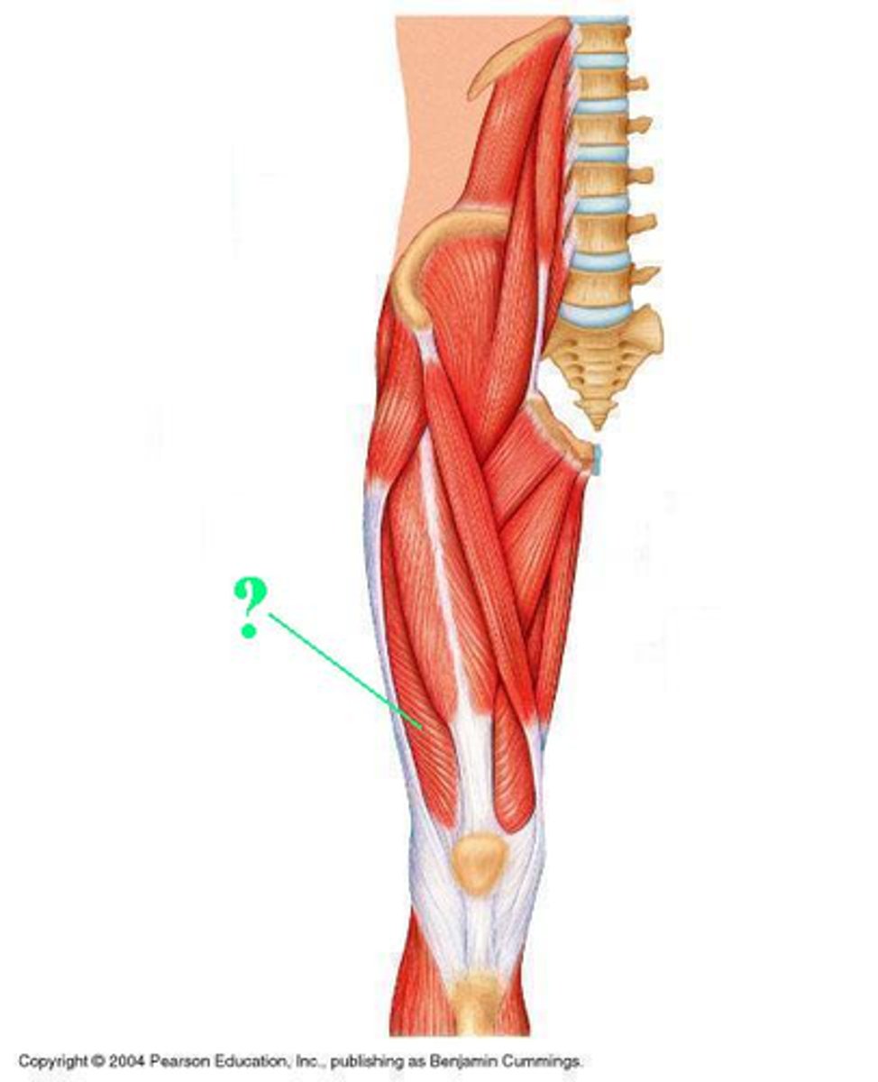 <p>Identify the indicated muscle</p>