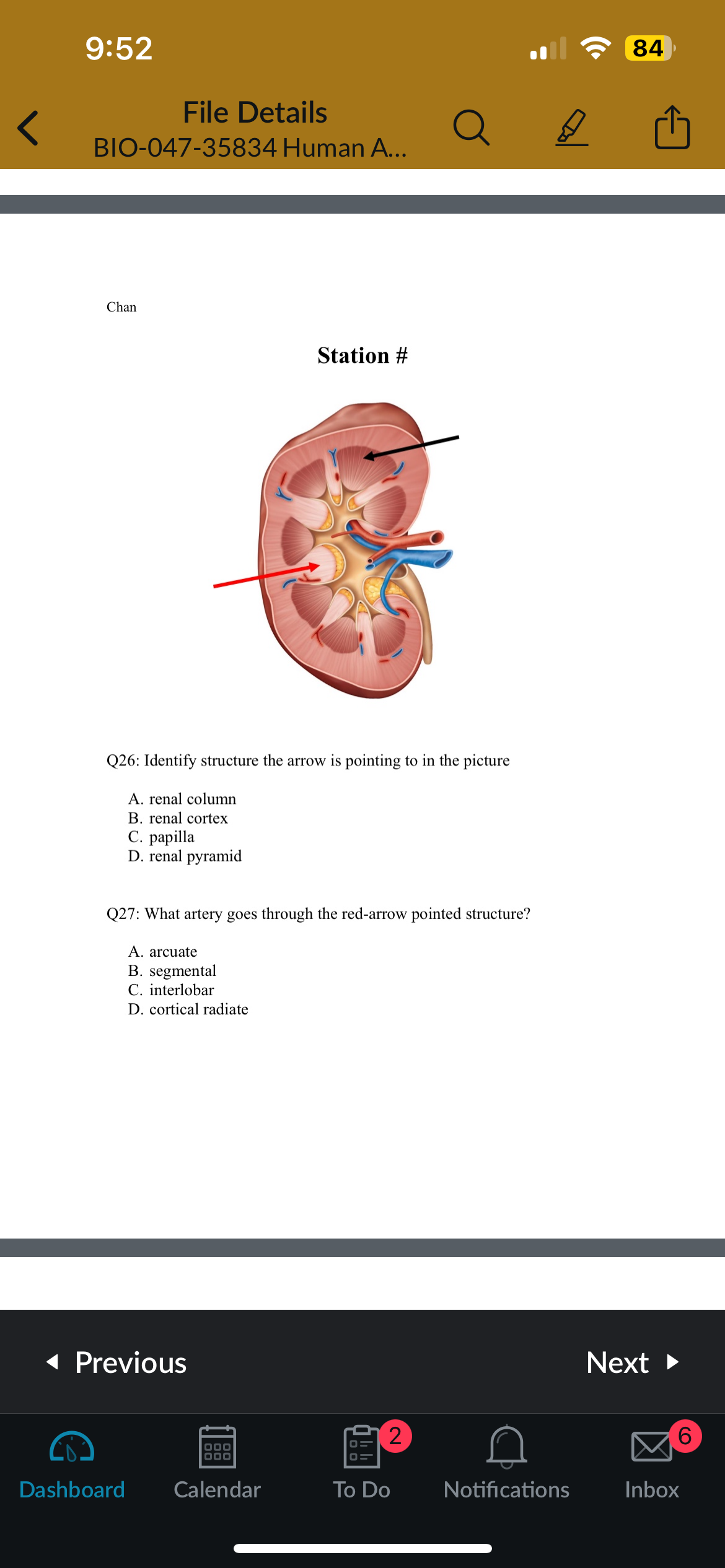 <p>Q26: Identify the structure the arrow is pointing to in the picture</p>