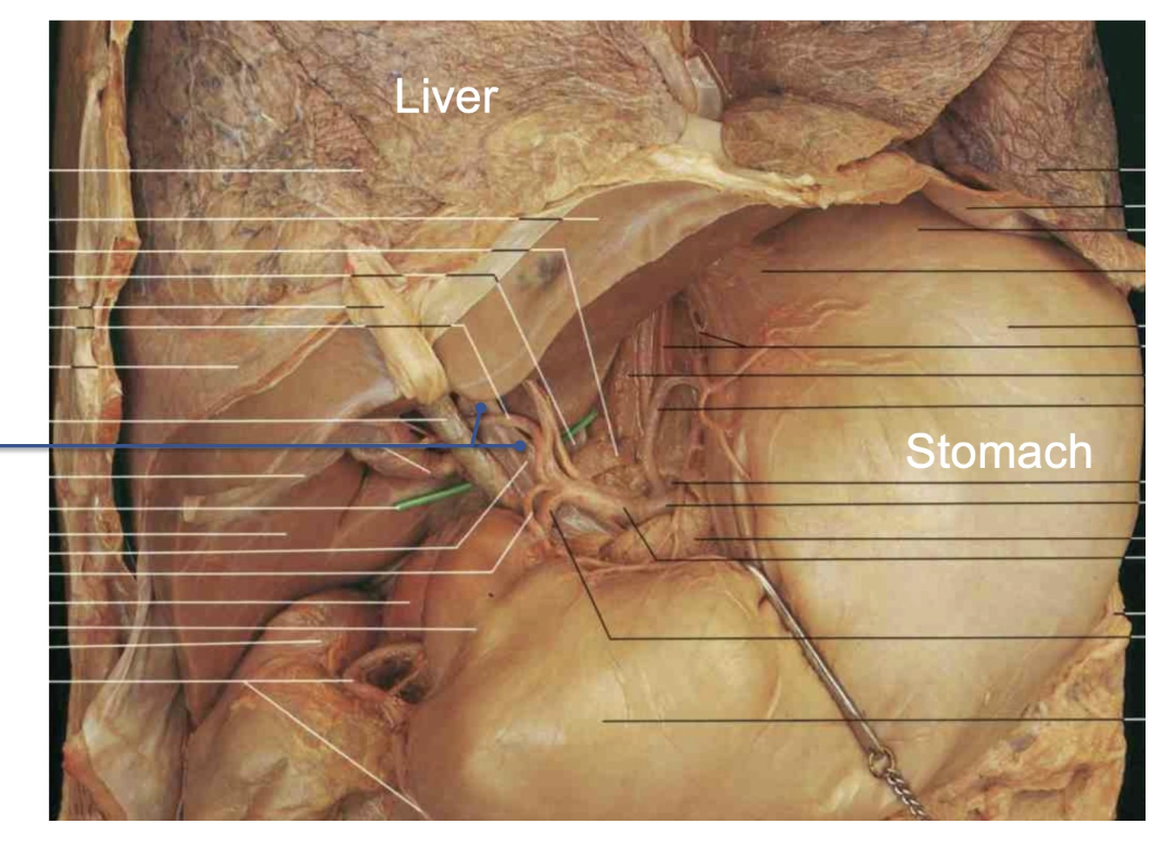 <p><span>Hypertension in the tagged vessel due to liver disease would most likely be associated with elevated pressure in which of the following vessels?</span></p>