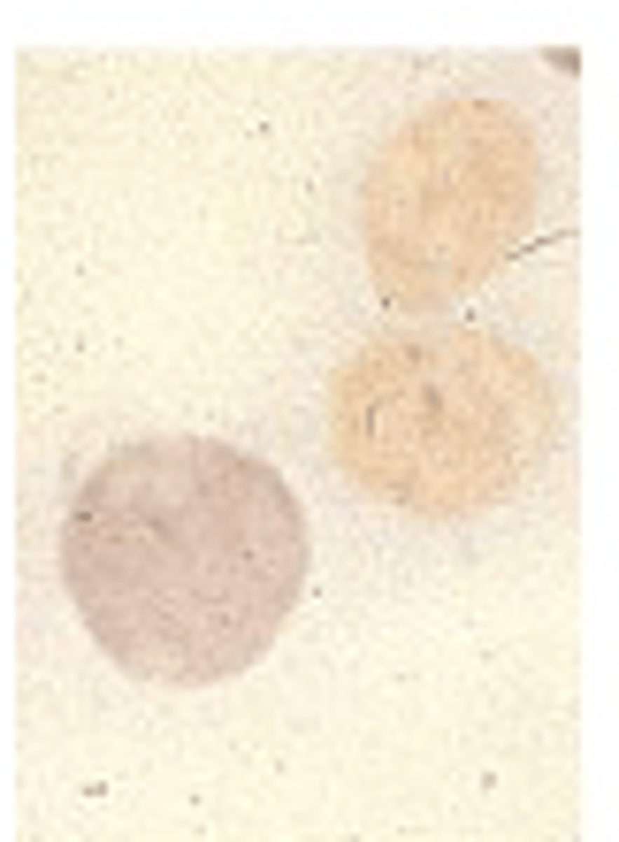 <p>What stage of erythropoiesis is observed?</p>
