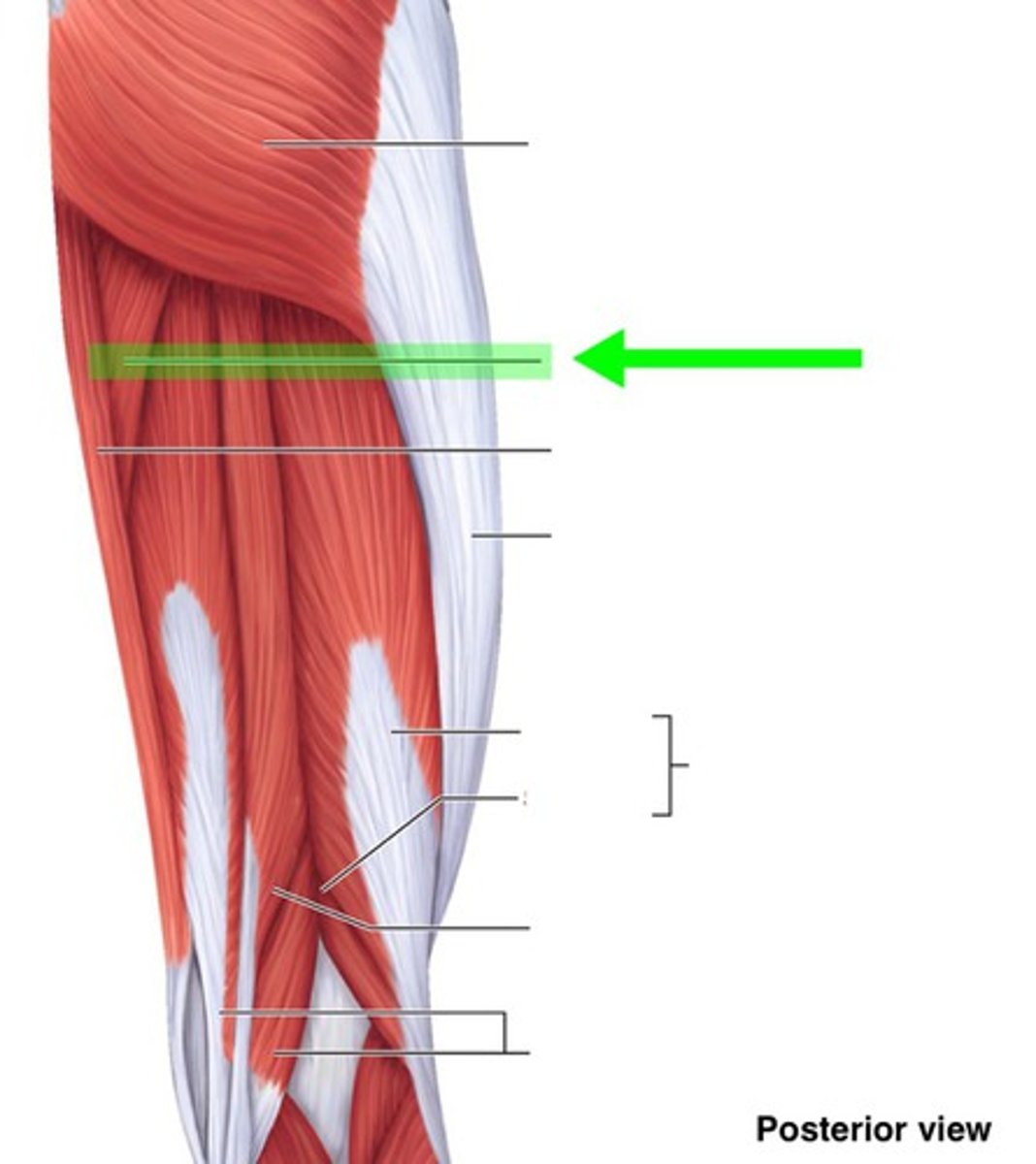 <p>What muscle is this?</p>