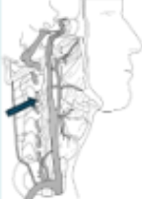 <p>What is the name of the vessel at the tip of the arrow?</p>