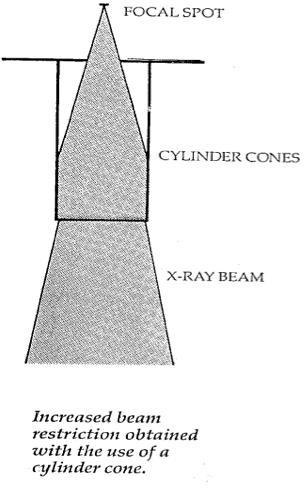<p><span><span>Blur is reduced because it truly limits the field size </span></span></p><p><span style="font-family: "Times New Roman";"><span>Circular field</span></span></p><p></p>