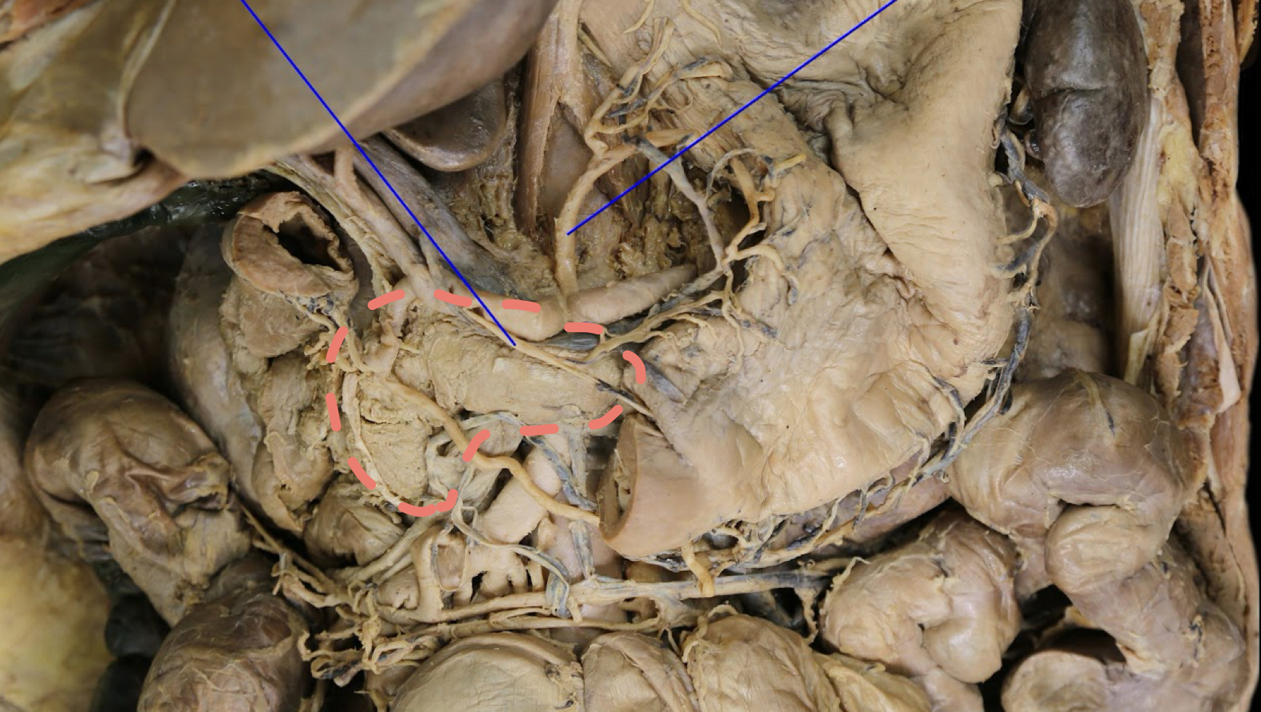 <p>A). Identify this structure<br>B). What supplies blood to this structure?</p>