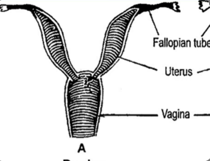 What type of uterus is this?