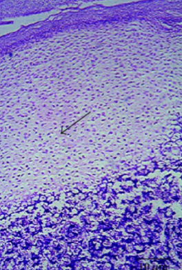 <p>where can this type of bone be found </p>