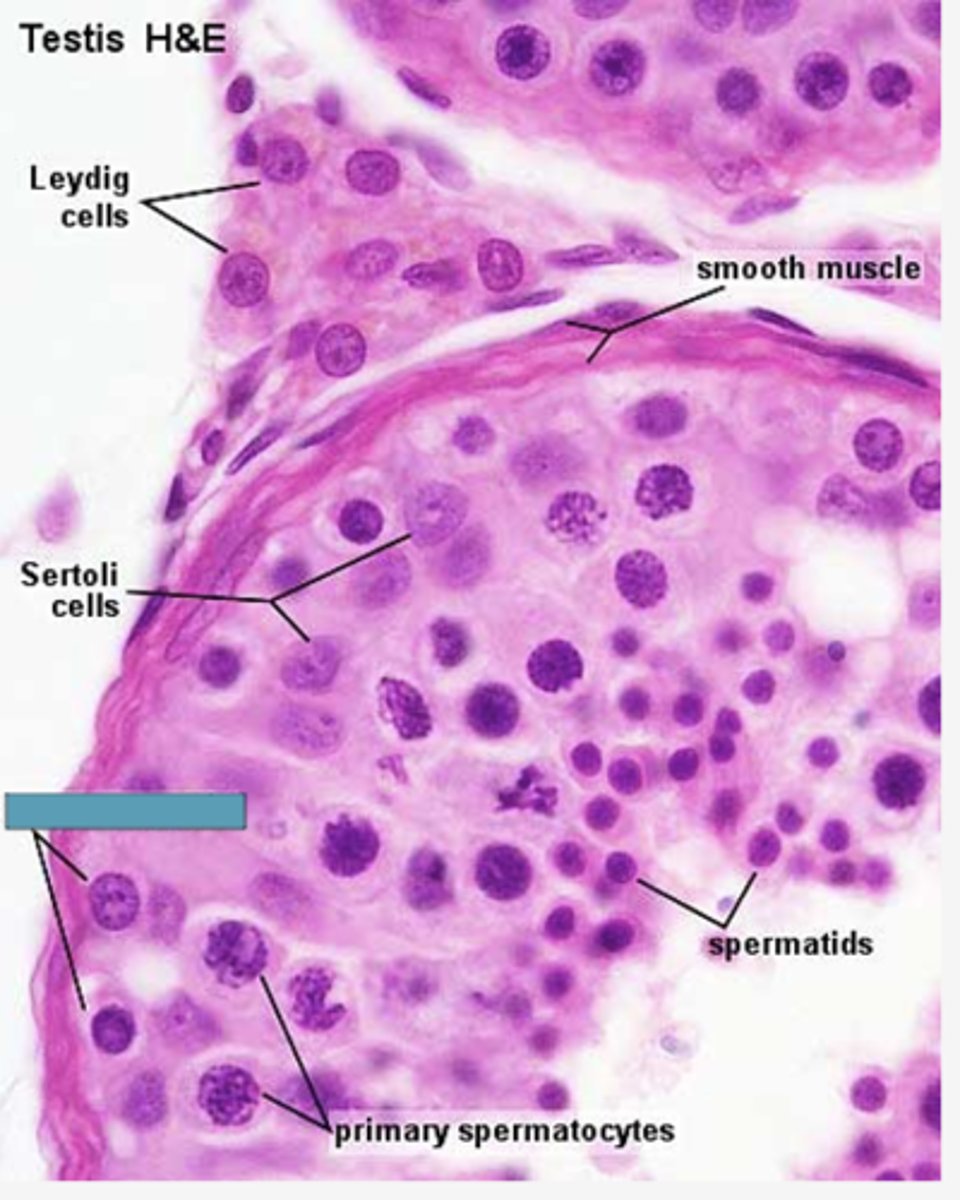 <p>Identify the cells</p>
