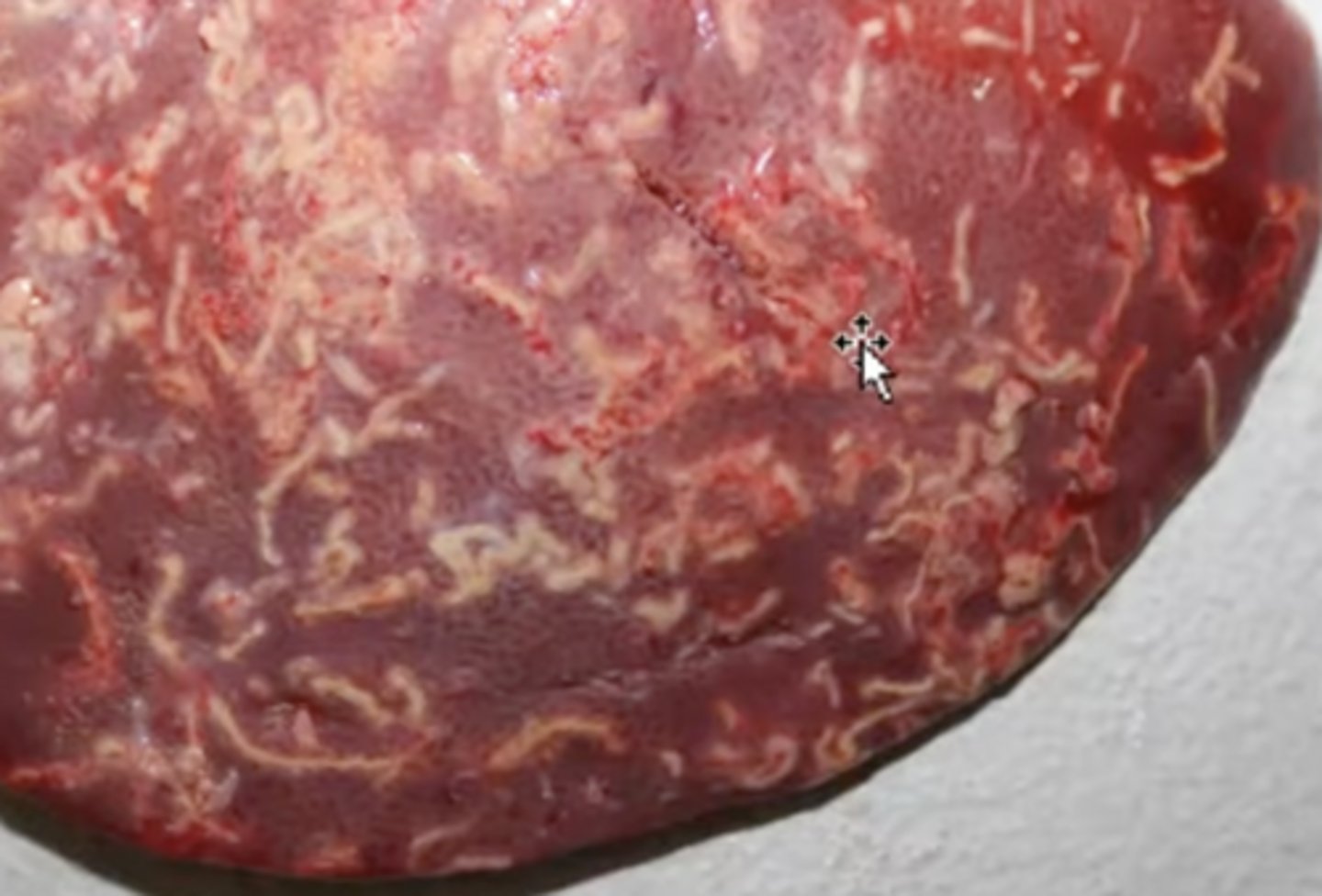 <p>What has caused this gross appearance of this liver?</p>