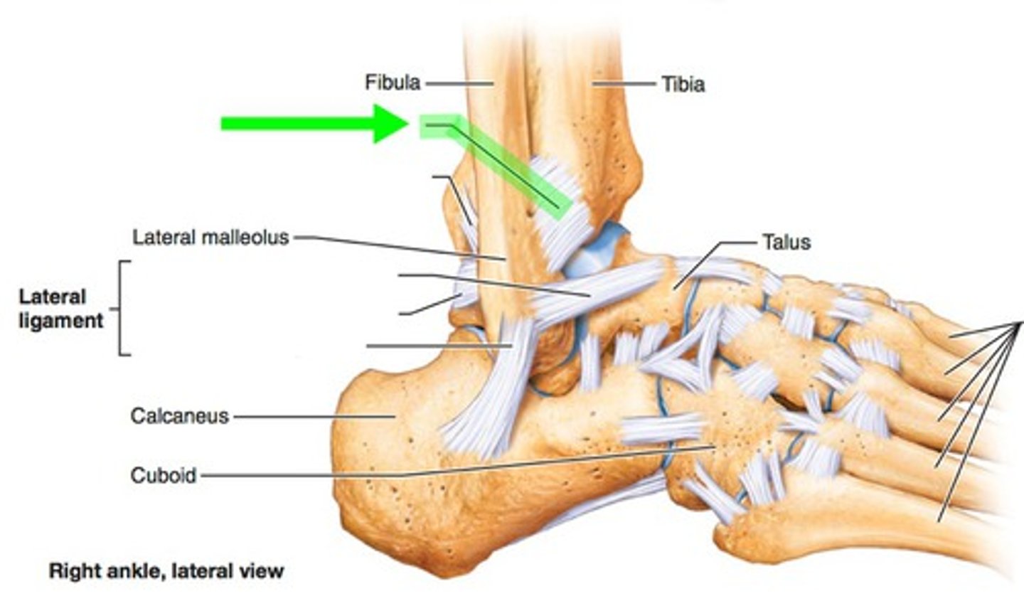 <p>Name this ligament</p>
