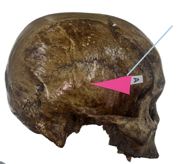 <p>Identify the bone structure labeled as A.</p><p>A. Temporal Bone</p><p>B. Occipital Bone</p><p>C. Parietal Bone</p><p>D. Frontal Bone</p>