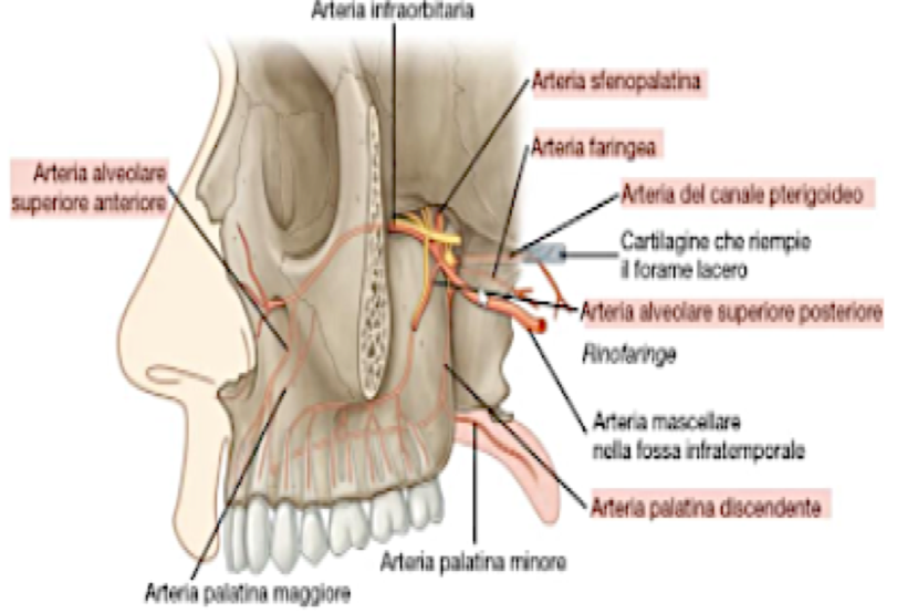 <p>Vascolarizzazione:</p><ul><li><p>Carotide Interna:</p><ul><li><p>Arteria Oftalmica con i rami etmoidali anteriori e posteriori verso la mucosa del tetto e parete mediale cavità nasale</p></li></ul></li><li><p>Carotide Esterna:</p><ul><li><p>Arteria Infraorbitaria, dalla mascellare, per la cute esterna</p></li><li><p>Arteria Sfenopalatina, dalla mascellare, attraversa il foro sfenopalatino dalla fossa pterigopalatina, per setto e pareti laterali</p></li><li><p>Arteria Faciale con l’arteria labiale superiore, per la punta del naso</p></li><li><p>Arteria Palatina Discendente, dalla mascellare, che prima di attraversare il canale palatino per raggiunge la cavità orale e inviare la palatina maggiore e minore, invia rami nasali che raggiungono la cavità nasale dal foro sfenopalatino</p></li></ul></li><li><p>Tutti questi rami si anastomizzano tra loro, per garantire la vascolarizzazione in caso di rottura:</p><ul><li><p>Riconosciamo l’Area di Kiesselbach o zona di Little a livello del setto antero inferiore → sede tipica di epistassi</p></li></ul></li><li><p>Vene:</p><ul><li><p>Plessi venosi submucosi → la loro ostruzioni causa la congestione nasale</p></li></ul></li></ul><p></p>