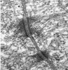 <p>what kind of intercellular junction is this&nbsp;</p>