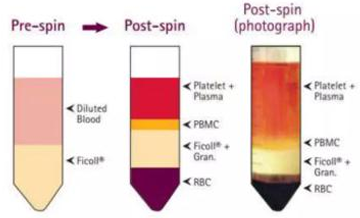 <p>What type of centrifuge?</p><ul><li><p>is a procedure for separating particles in which a sample is placed in a preformed gradient such as sucrose. Upon contrifugation, the particles are “banded” in the gradient and can be collected as a pure fraction</p></li></ul><p></p>