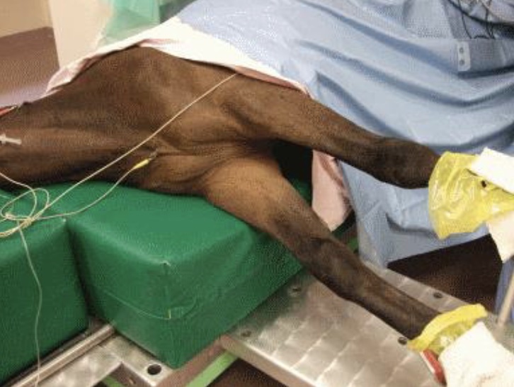 gait disorder: radial nerve injury