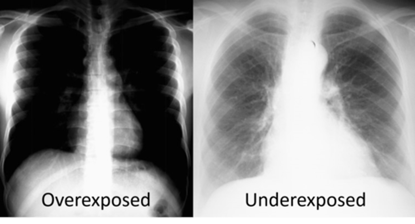<p>kVp, mAs, source to plate distance</p>